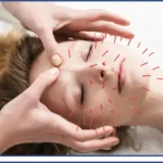 Acupuncture Billing Services